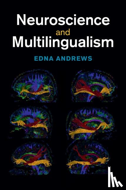 Andrews, Edna (Duke University - Neuroscience and Multilingualism