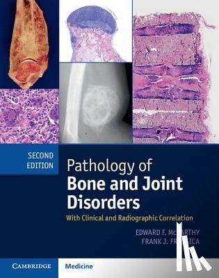 McCarthy, Edward F. - PATHOLOGY OF BONE & JOINT DISO