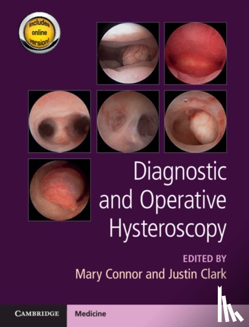  - Diagnostic and Operative Hysteroscopy