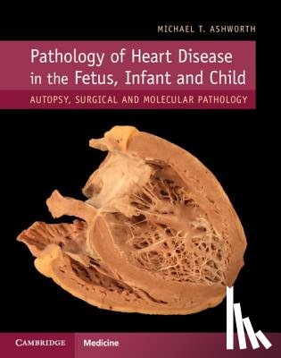 Ashworth, Michael T. - Pathology of Heart Disease in the Fetus, Infant and Child