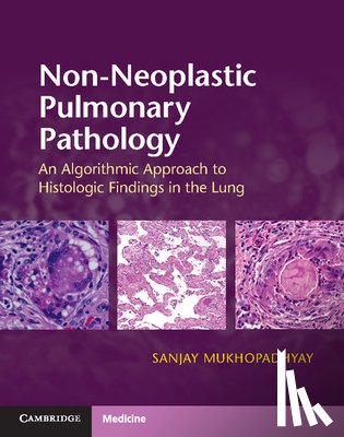 Mukhopadhyay, Sanjay - NON-NEOPLASTIC PULMONARY PATHO