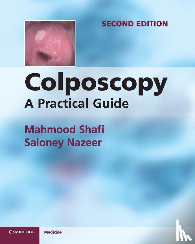 Shafi, Mahmood, Nazeer, Saloney - Colposcopy