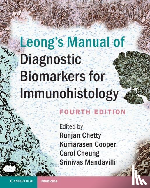  - Leong's Manual of Diagnostic Biomarkers for Immunohistology