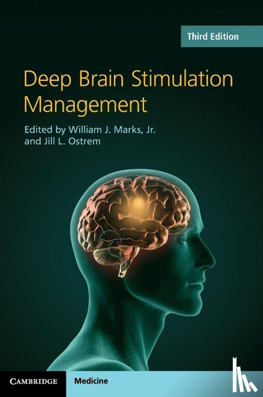  - Deep Brain Stimulation Management