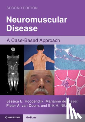 Hoogendijk, Jessica E. (University Medical Center Utrecht), de Visser, Marianne (Amsterdam University Medical Center), van Doorn, Pieter A. (Erasmus MC, Niks, Erik H. (Leiden University Medical Center) - Neuromuscular Disease