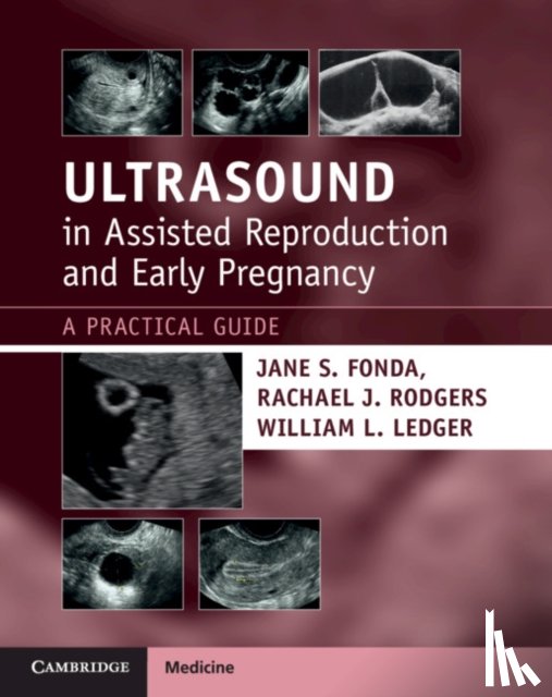 Fonda, Jane S. (University of Sydney), Rodgers, Rachael J., Ledger, William L. (University of New South Wales - Ultrasound in Assisted Reproduction and Early Pregnancy