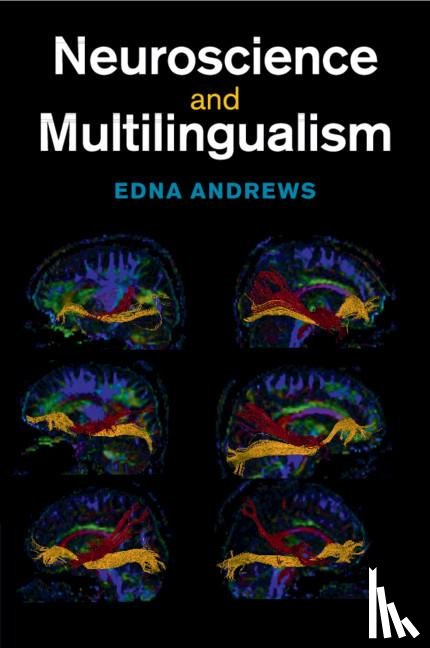 Andrews, Edna (Duke University - Neuroscience and Multilingualism