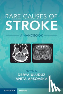 Arsovska, Anita - Rare Causes of Stroke