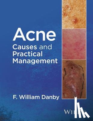 Danby, F. William (Department of Dermatology - Acne