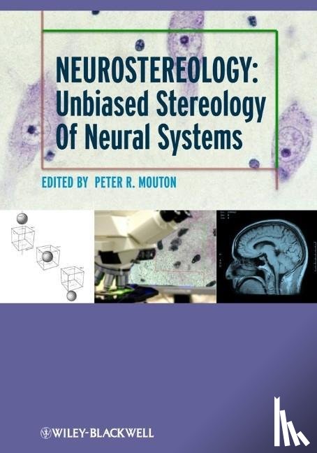 Mouton, P. R. (University of South Florida - Neurostereology
