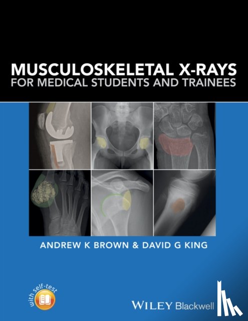 Brown, Andrew K. (Consultant Rheumatologist and Senior Lecturer in Medical Education, King, David G. (Consultant Musculoskeletal Radiologist - Musculoskeletal X-Rays for Medical Students and Trainees