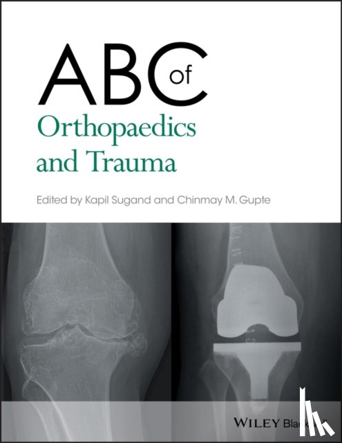  - ABC of Orthopaedics and Trauma