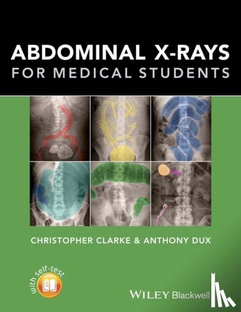 Clarke, Christopher (Nottingham University Hospitals), Dux, Anthony (University Hospitals of Leicester) - Abdominal X-rays for Medical Students