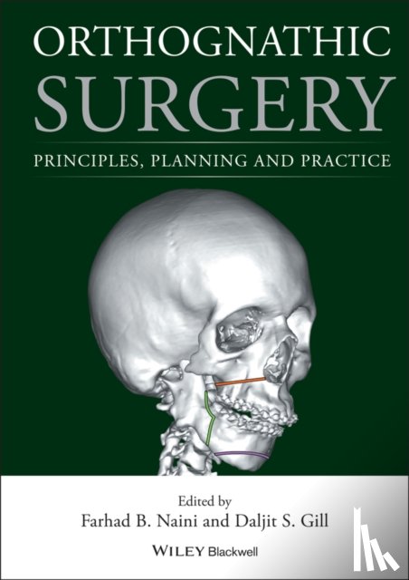  - Orthognathic Surgery