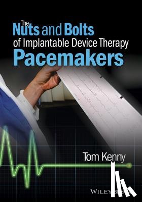 Kenny, Tom (FHRS - The Nuts and Bolts of Implantable Device Therapy