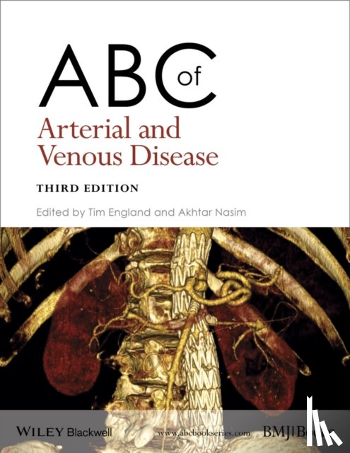  - ABC of Arterial and Venous Disease
