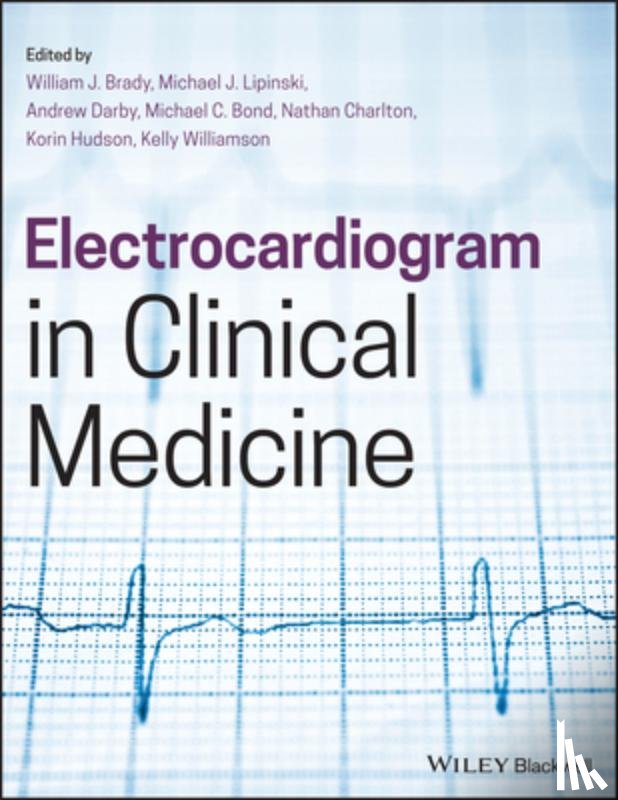  - Electrocardiogram in Clinical Medicine