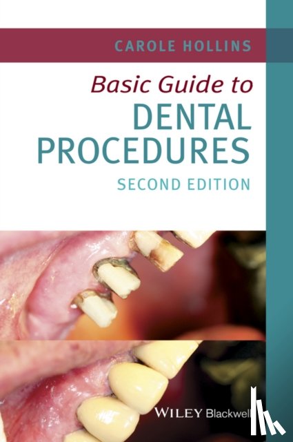 Hollins, Carole (Dental practitioner, UK) - Basic Guide to Dental Procedures
