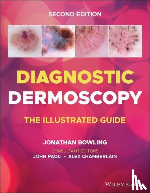  - Diagnostic Dermoscopy