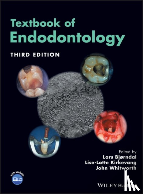  - Textbook of Endodontology