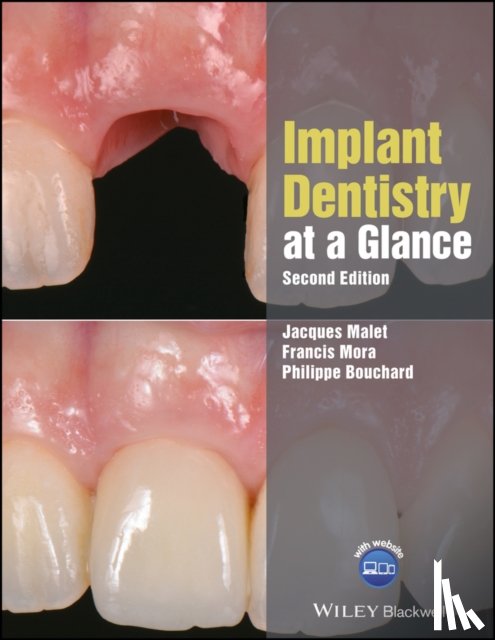 Malet, Jacques ( Assistant Professor of Clinical Dentistry, Mora, Francis ( Associate Professor, Bouchard, Philippe ( Professor - Implant Dentistry at a Glance