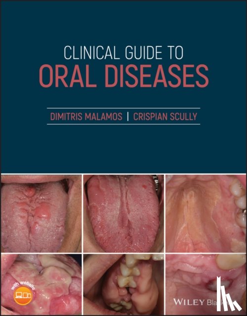 Malamos, Dimitris, Scully, Crispian, CBE (University College London) - Clinical Guide to Oral Diseases