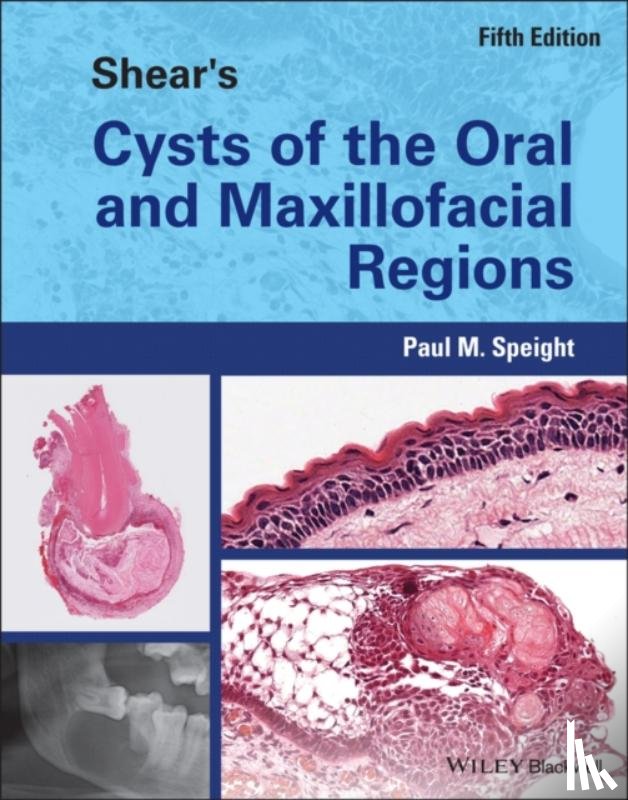 Speight, Paul M. (School of Clinical Dentistry - Shear's Cysts of the Oral and Maxillofacial Regions