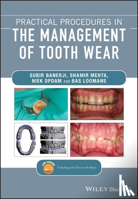 Banerji, Subir (King's College London Dental Institute, Mehta, Shamir B. (King's College London Dental Institute, Opdam, Niek, Loomans, Bas - Practical Procedures in the Management of Tooth Wear
