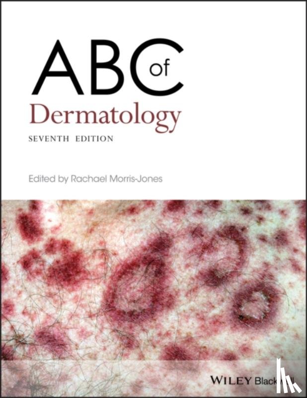  - ABC of Dermatology