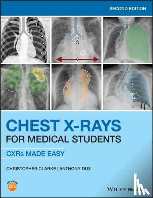 Clarke, Christopher (ST2 Clinical Radiology Trainee at Nottingham University Hospitals and Honorary Lecturer in Human Anatomy at Nottingham Medical School), Dux, Anthony (Consultant Radiologist at University Hospitals of Leicester NHS Trust) - Chest X-Rays for Medical Students