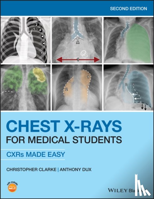 Christopher Clarke, Anthony Dux - Chest X-Rays for Medical Students