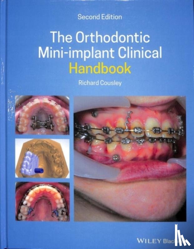 Cousley, Richard (Consultant Orthodontist for the Peterborough & Stamford Hospitals NHS Foundation Trust) - The Orthodontic Mini-implant Clinical Handbook