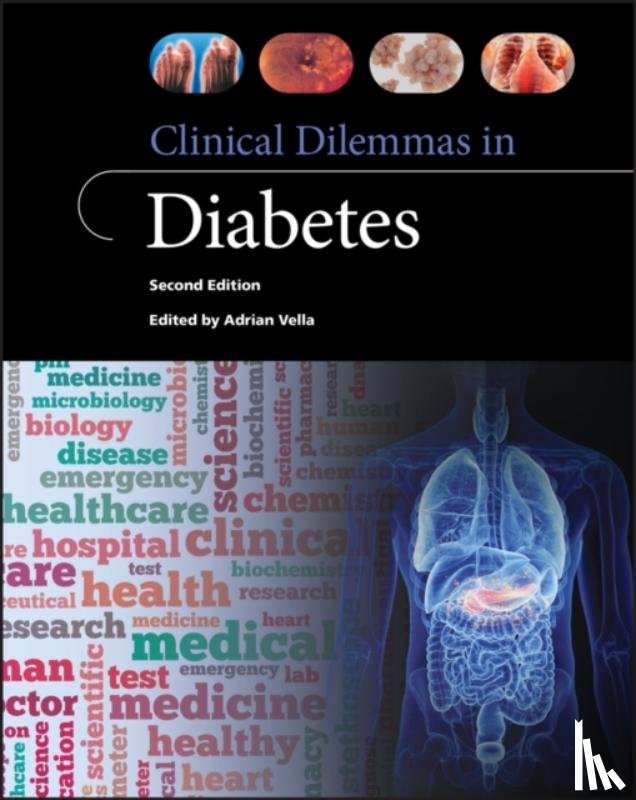  - Clinical Dilemmas in Diabetes