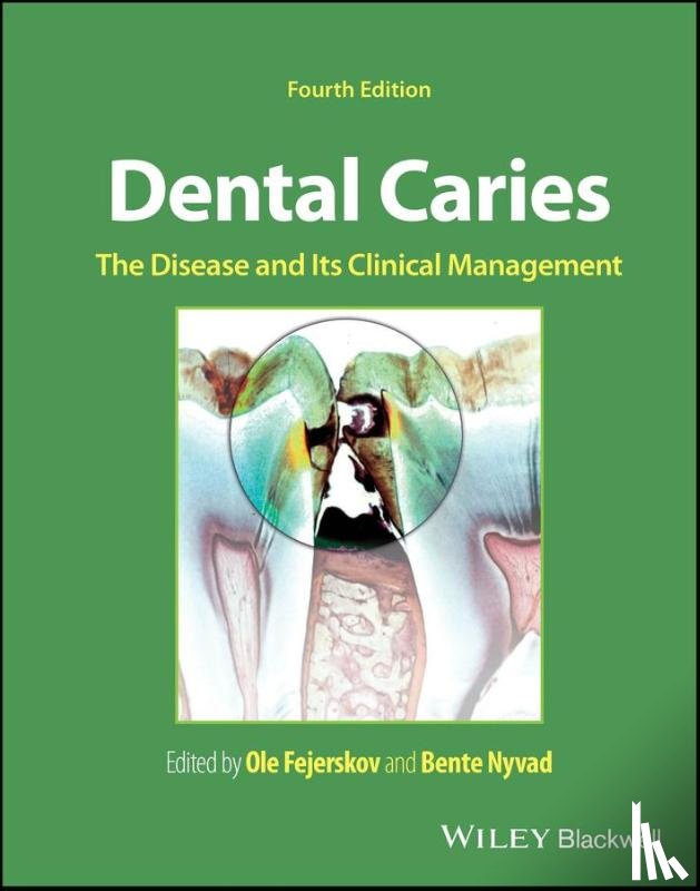  - Dental Caries