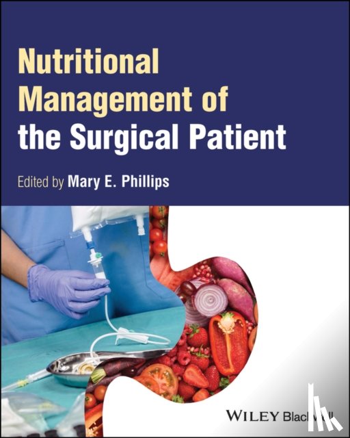  - Nutritional Management of the Surgical Patient
