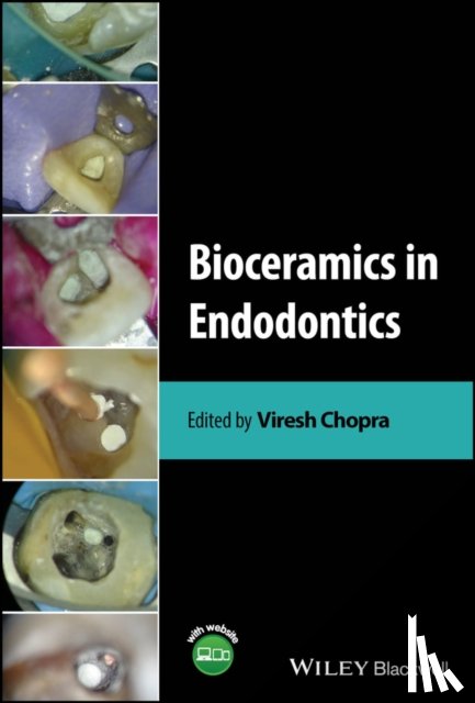  - Bioceramics in Endodontics