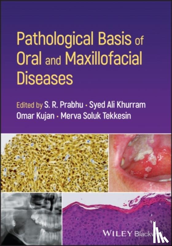  - Pathological Basis of Oral and Maxillofacial Diseases