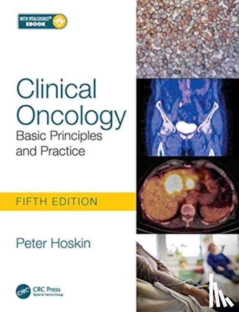 Hoskin, Peter (University of Manchester - Clinical Oncology