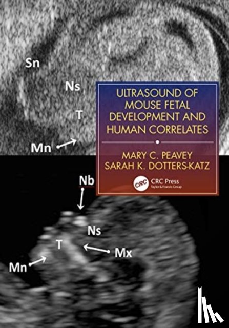 Peavey, Mary C., Dotters-Katz, Sarah K. - Ultrasound of Mouse Fetal Development and Human Correlates
