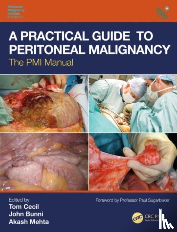  - A Practical Guide to Peritoneal Malignancy
