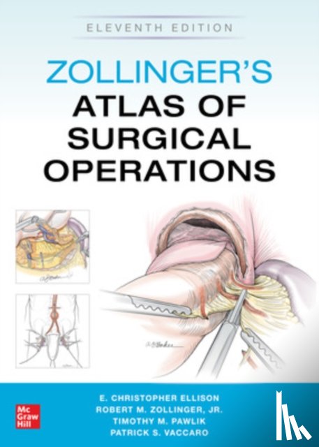 Zollinger, Robert, Ellison, E., Pawlik, Timothy, Vaccaro, Patrick - Zollinger's Atlas of Surgical Operations, Eleventh Edition