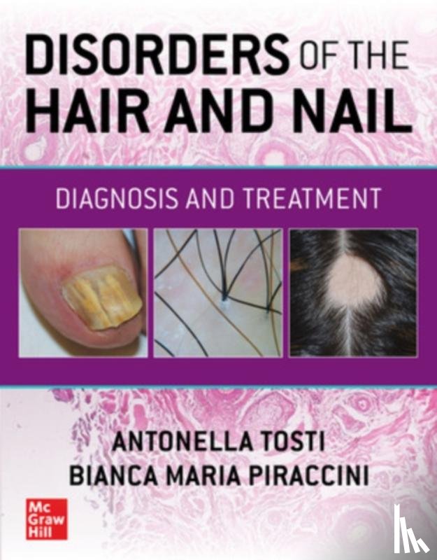 Tosti, Antonella, Piraccini, Bianca Maria - Disorders of the Hair and Nail: Diagnosis and Treatment