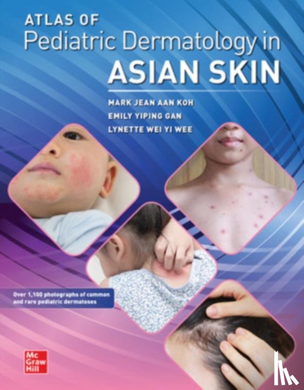 Koh, Mark Jean Aan, Gan, Emily Yiping, Wee, Lynette Wie Yi - Atlas of Pediatric Dermatology in Asian Skin