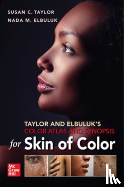 Taylor, Susan, Elbuluk, Nada - Taylor and Elbuluk's Color Atlas and Synopsis for Skin of Color