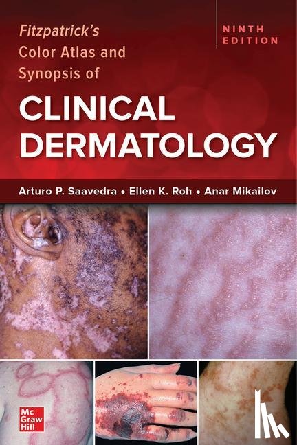 Saavedra, Arturo, Roh, Ellen, Mikailov, Anar - Fitzpatrick's Color Atlas and Synopsis of Clinical Dermatology, Ninth Edition