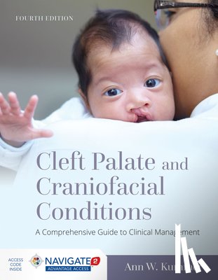 Kummer, Ann W. - Cleft Palate and Craniofacial Conditions: a Comprehensive Guide to Clinical Management