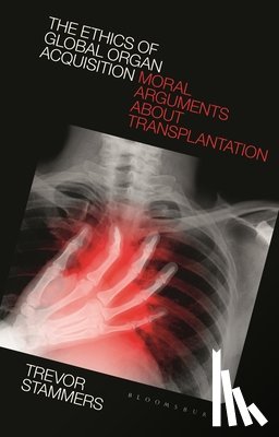 Stammers, Trevor (St. Mary's University - The Ethics of Global Organ Acquisition