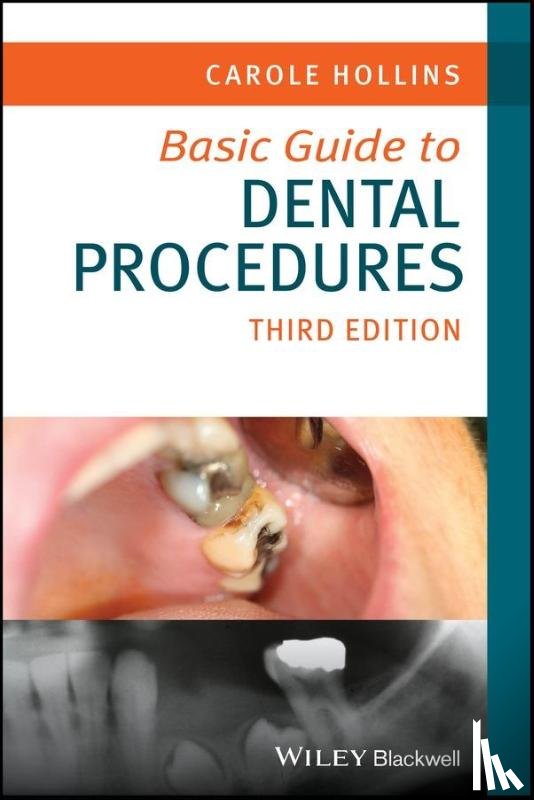 Hollins, Carole (British Dental Association) - Basic Guide to Dental Procedures
