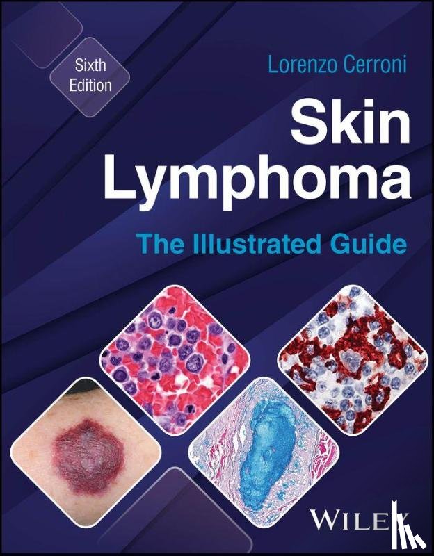 Cerroni, Lorenzo (Medical University of Graz - Skin Lymphoma