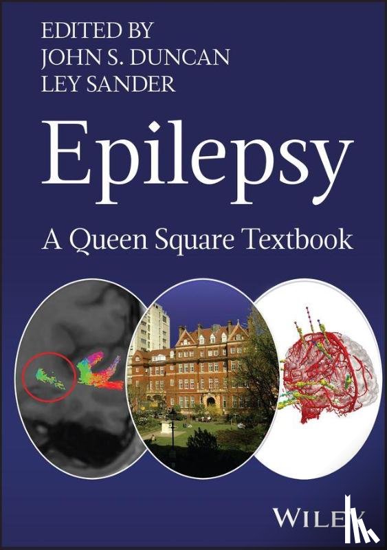  - Epilepsy